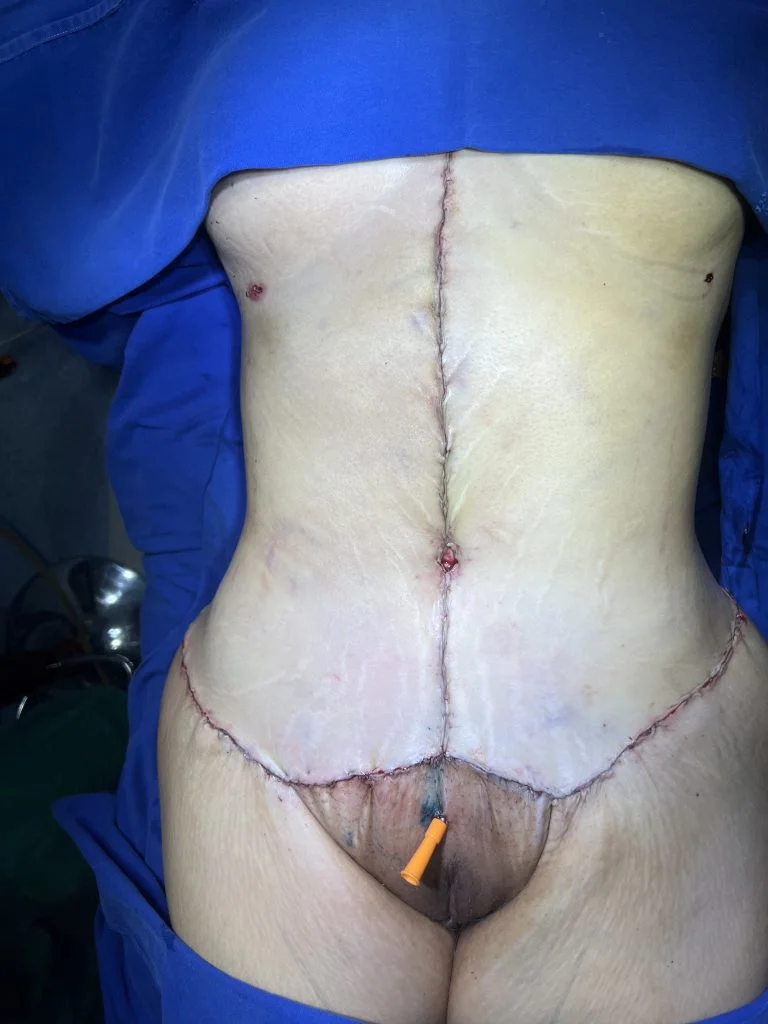 flor de lis después